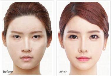 整形醫(yī)院哪里好？