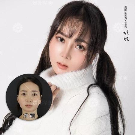 會(huì)縫衣服就會(huì)割雙眼皮！