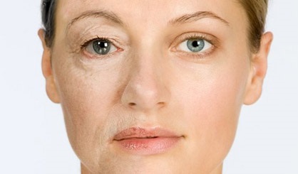 自體脂肪除皺的費(fèi)用是多少？