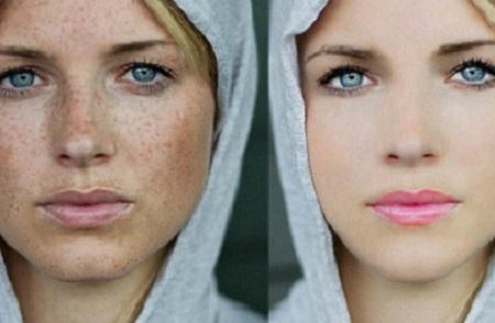 祛斑好方法有哪些？