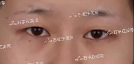 這些眼睛一點(diǎn)都不招人喜歡！