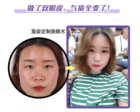 這些眼睛一點(diǎn)都不招人喜歡！