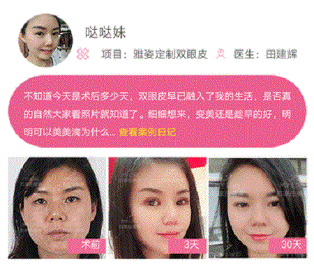 這些眼睛一點(diǎn)都不招人喜歡！