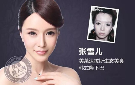  23-24日，韓國較會(huì)整容的柳元敏博士，來了！