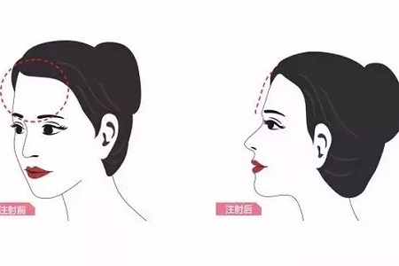 知道么？額頭飽滿的女人好命