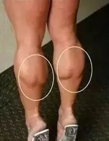 “腿精”不是你想做就能做的，你瘦腿了嗎？