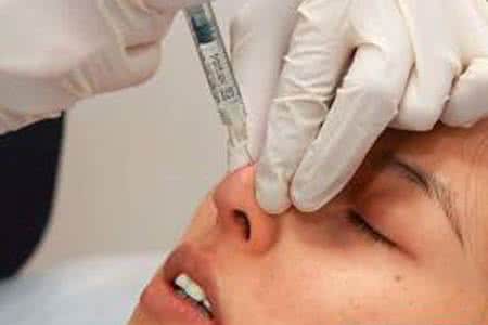 注射玻尿酸隆鼻的價格是多少?