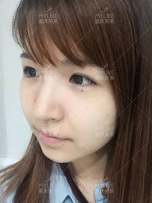 抗初老警報！萬物皆上漲、唯有臉下垂，你還說你不是老阿姨