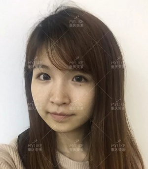 抗初老警報！萬物皆上漲、唯有臉下垂，你還說你不是老阿姨