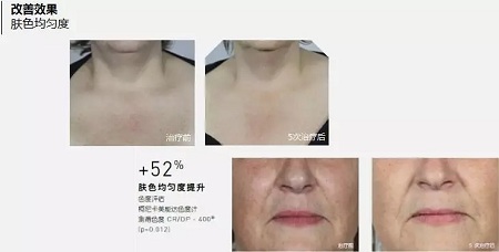 抗衰老的“水光”究竟為何飽受稱贊？
