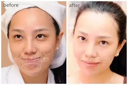 沒有誰能永遠(yuǎn)年輕，不老都是保養(yǎng)的早！