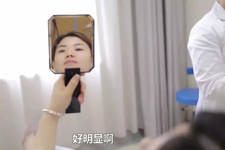 法令紋、川字紋