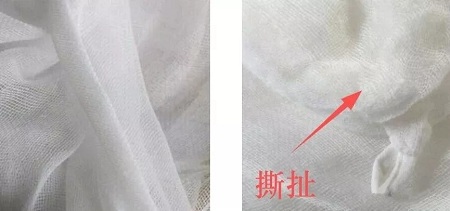 為什么瘦人也會(huì)有“肥胖紋”？