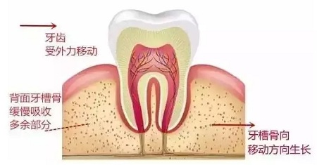 做牙齒矯正 ，真的要趁早！