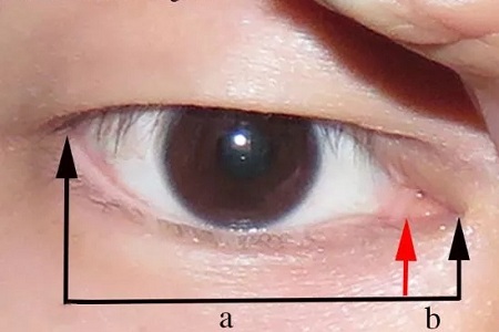 開眼角和不開眼角，差距有多大？