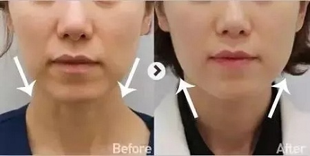 想要衰老來(lái)的慢一點(diǎn)，你得學(xué)會(huì)保養(yǎng)！