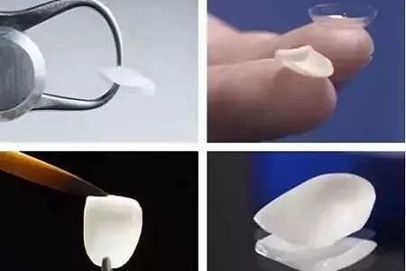 問診室：為什么我的牙卻永遠(yuǎn)也刷不白？