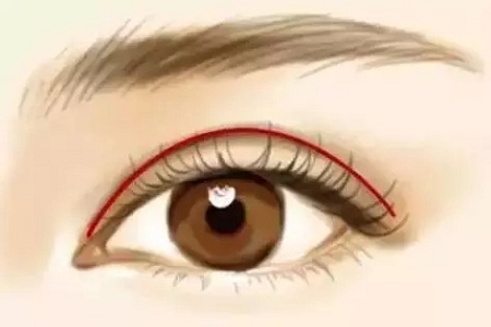 市面上五花八門的雙眼皮項目，如何有效找到你的菜？