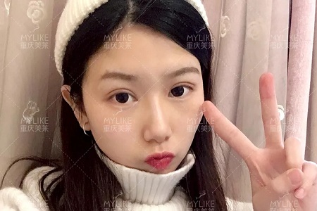 市面上五花八門的雙眼皮項目，如何有效找到你的菜？