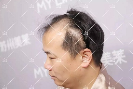 好看的皮囊千千萬，但都有一個共同點-頭發(fā)！