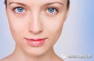 25歲以后，這些醫(yī)美項(xiàng)目可比你們的所有護(hù)膚品都強(qiáng)！