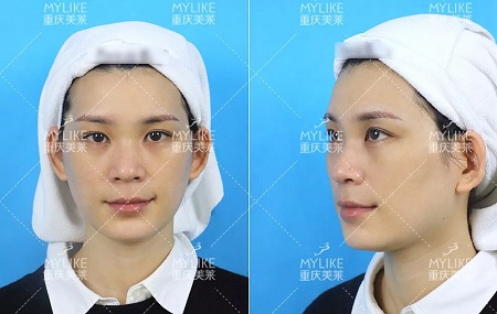 那個(gè)斑點(diǎn)女孩后來怎么樣了？