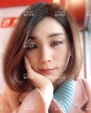 那個(gè)斑點(diǎn)女孩后來怎么樣了？