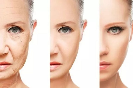 假如年齡可以撒謊，那必然是除皺美容的作用！