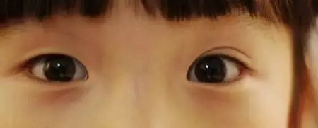 大小眼、不對(duì)稱，你是長(zhǎng)胖了還是真老了？