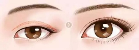 大小眼、不對(duì)稱，你是長(zhǎng)胖了還是真老了？