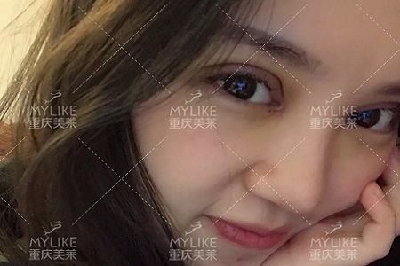 大小眼、不對(duì)稱，你是長(zhǎng)胖了還是真老了？