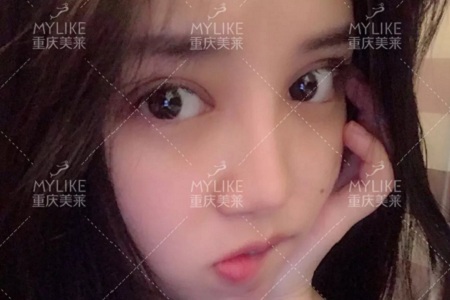 大小眼、不對(duì)稱，你是長(zhǎng)胖了還是真老了？