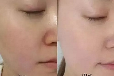 如何在炎熱的夏天，做清爽白凈的小姐姐？