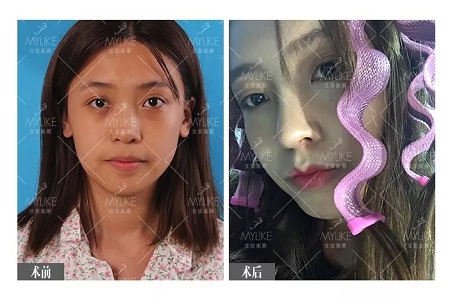 顏值：鼻子一小步，顏值一大步~