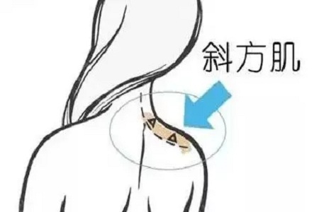 成功減肥20斤為什么還被吐槽又老又丑？