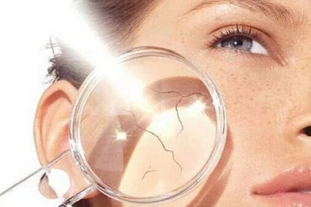 問診室：祛斑不難，找對病因才是重點，祛斑較全面科普看過來