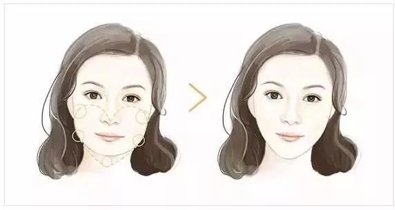 玻尿酸+瘦臉這樣打，方臉、大餅臉都能變小V臉！