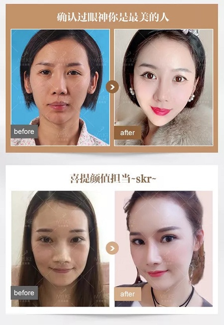 美萊實驗室：瘦臉、ReFa都解決不了你的臉大問題交給我就對了