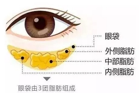 還把眼袋當臥蠶？那就別怪小弟弟喊你阿姨了