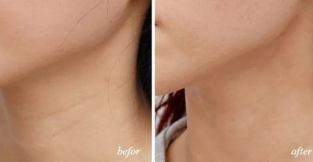 悄咪咪的年輕十歲，撫平頸紋一起“嗨”