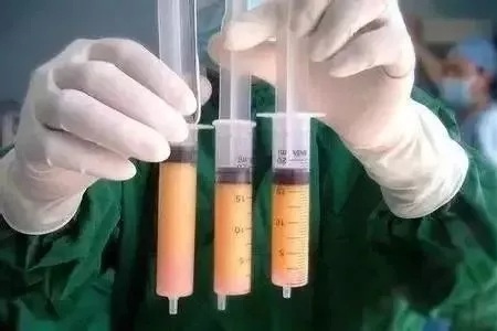 顯老淚溝，你還要任其放肆嗎？