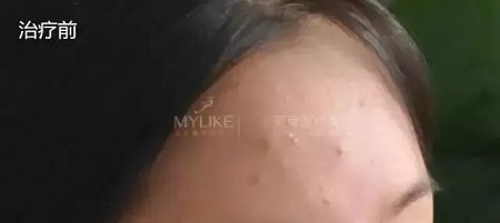 粗糙、毛孔粗大、起皮......換季肌膚問題如何解決？