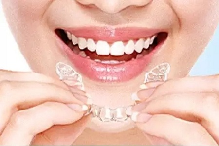 美萊隱形矯正，你笑起來的樣子特別美！