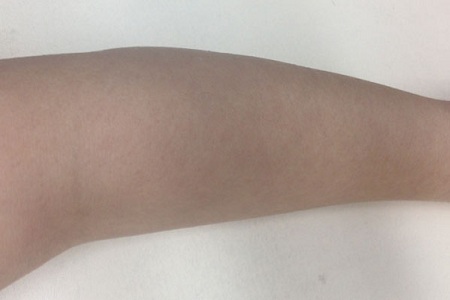 衡陽脫毛一般有哪些注意事項(xiàng)