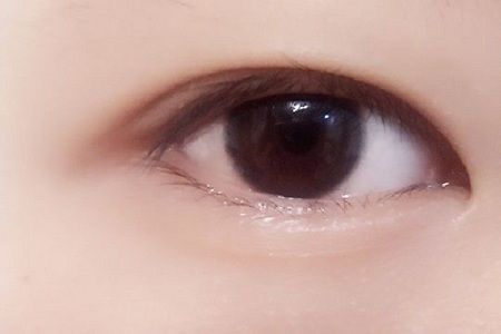 成都激光去眼袋得多少錢(qián)