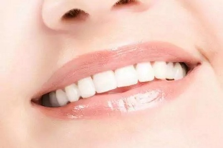 牙齒矯正前，你該知道的事