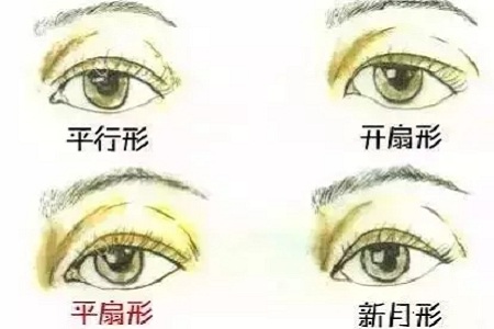 平行、扇形、新月形