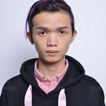 美萊案例李琦對(duì)比圖后