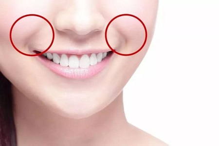 減輕法令紋的注意事項有哪些