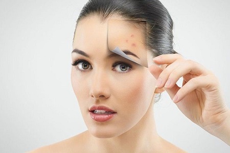 貴陽(yáng)怎樣去青春痘效果好